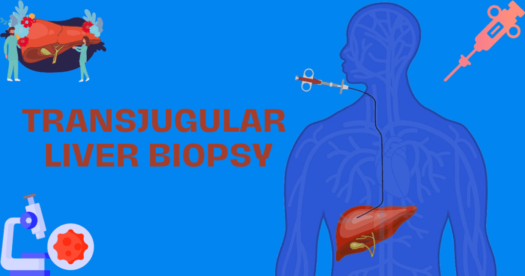 Transjugular Liver Biopsy